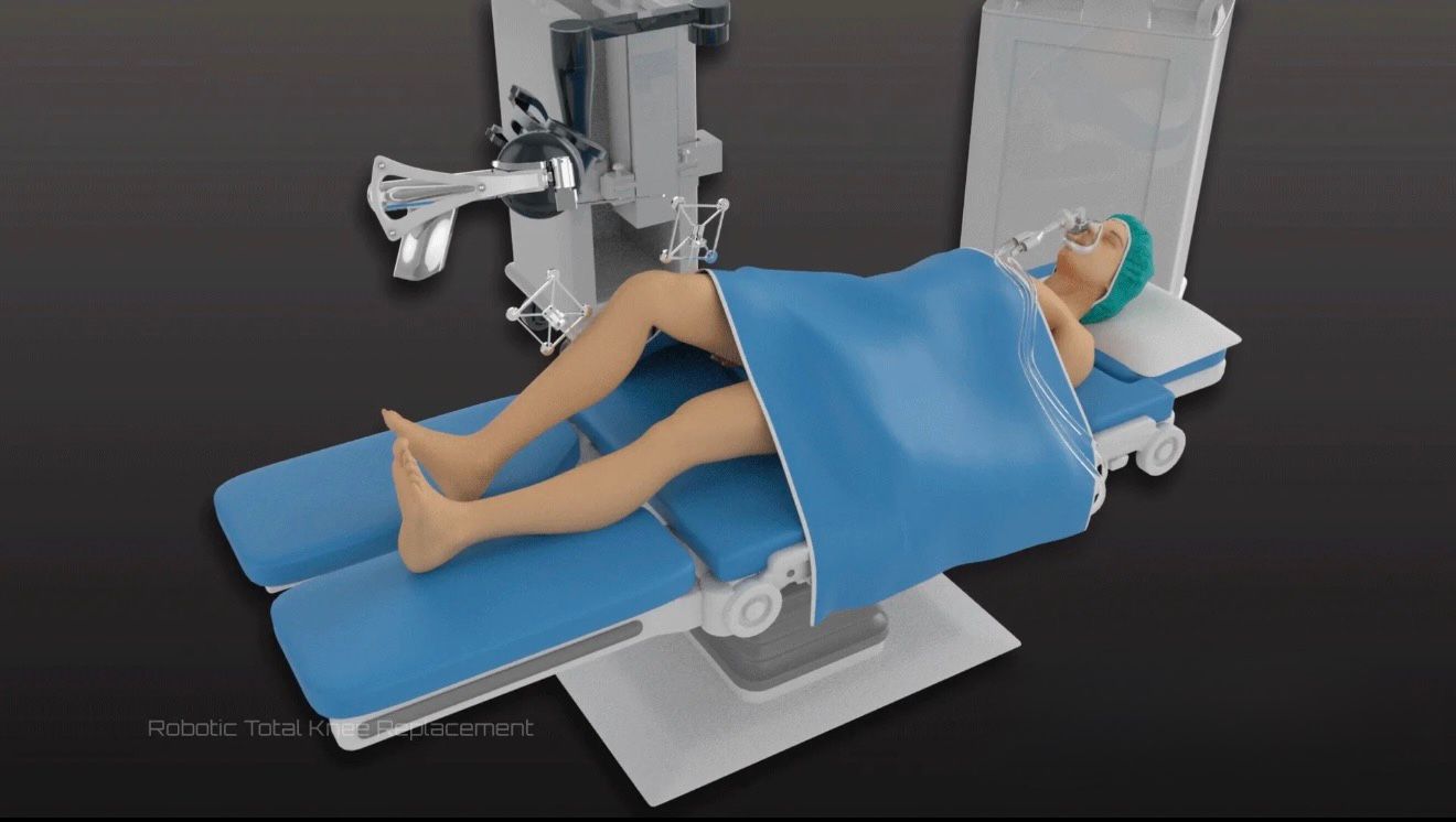 Robotic knee replacement precision planning